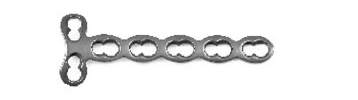 Т-подібна блокуюча пластина для остеосинтезу фаланги пальця Jinlu